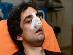 AA ekibine çirkin saldırı