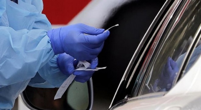 ABD'de koronavirüs testinin vatandaşlara maliyeti özel sektörde 135 devlette ise 1600 dolar!