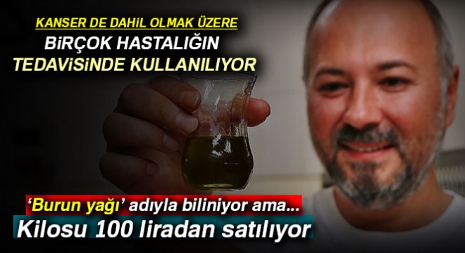 Çiğ burun yağı şifa kaynağı