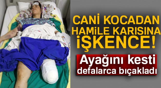 Hamile karısına işkence yapıp tüfekle vurdu