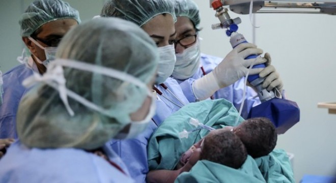 Tek karaciğerle düyaya geldiler